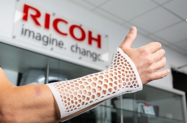 3D-printed wrist and forearm brace, with an organic lattice structure. 